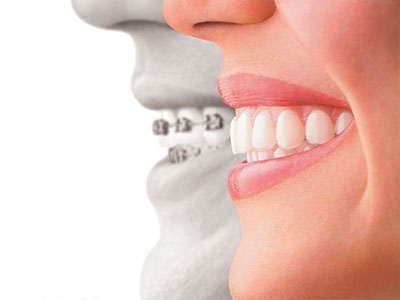 Cinema Smile Dental | Veneers, Extractions and Full Mouth Reconstruction