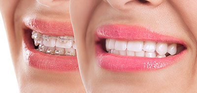 Cinema Smile Dental | Periodontal Treatment, Full Mouth Reconstruction and Teeth Whitening