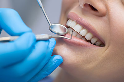 Cinema Smile Dental | Fluoride Treatment, Rotary Endodontics and Preventative Program