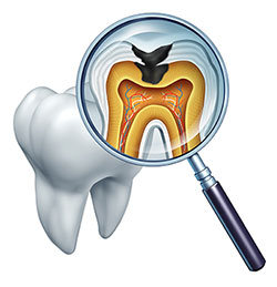 Cinema Smile Dental | Dental Sealants, Digital Radiography and Full Mouth Reconstruction