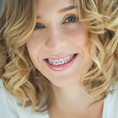 Cinema Smile Dental | Inlays  amp  Onlays, Clear Aligners and Implant Dentistry