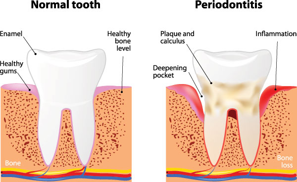 Cinema Smile Dental | Dentures, Preventative Program and Ceramic Crowns