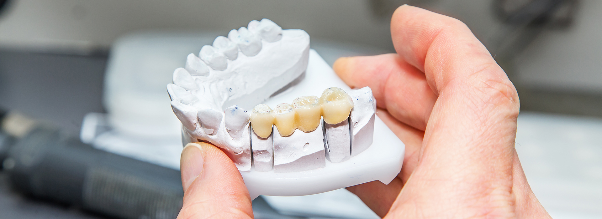 Cinema Smile Dental | Dental Fillings, Clear Aligners and Digital Radiography