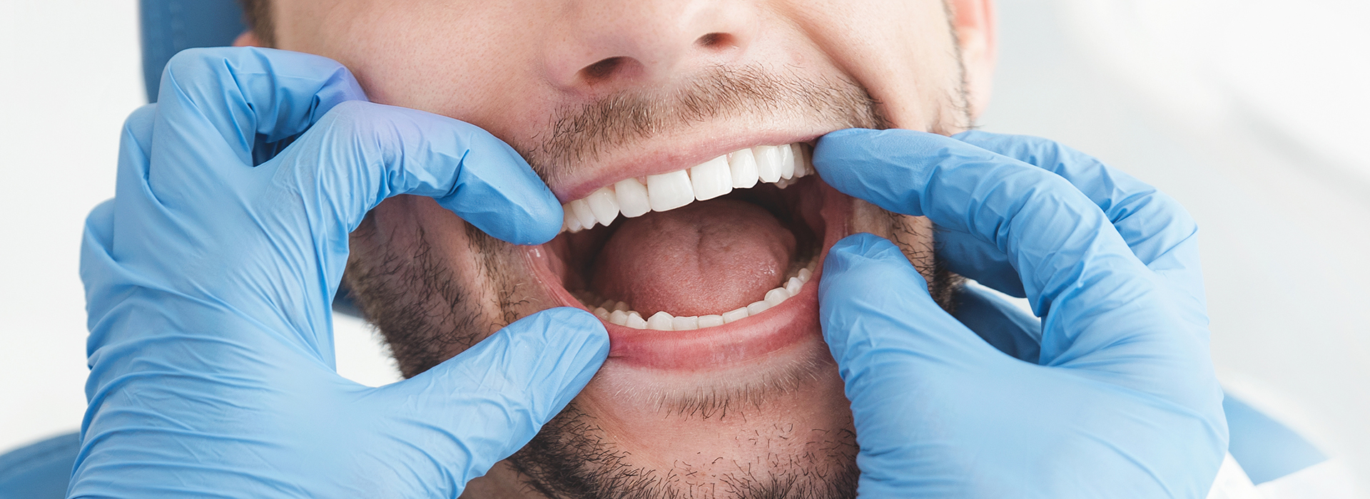 Cinema Smile Dental | Periodontal Treatment, Veneers and Dental Cleanings